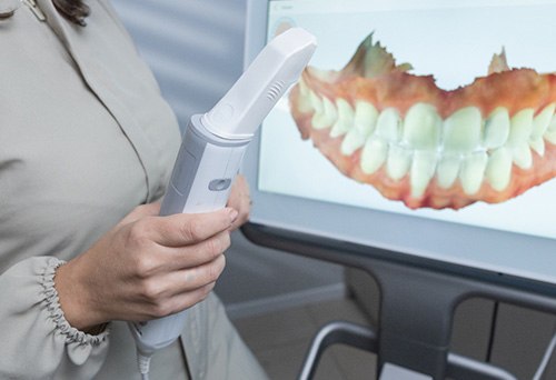 Hand holding digital impression device in front of screen showing dental scan