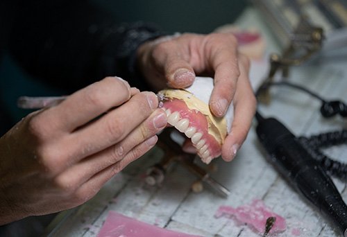 Hands of lab tech working on wax gumline of dentures