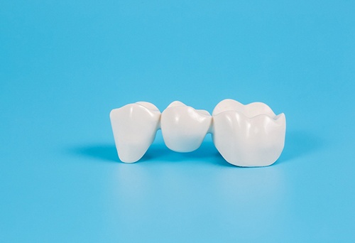 Dental bridge with a light blue background